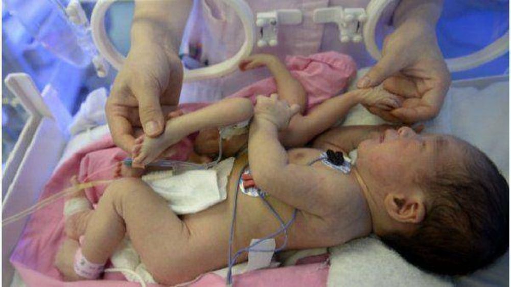 Nace en China un beb con cuatro piernas y cuatro brazos
