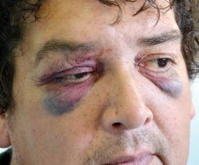 Balean en el rostro a un hombre
