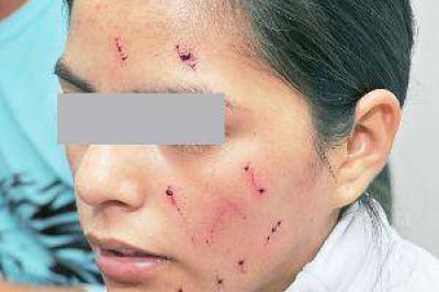 Raptan a una adolescente y le cortan la cara con un bistur�