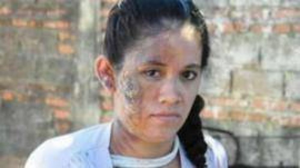 La chica quemada con agua hirviendo fue atacada por la ex de su novio