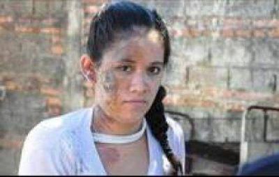 Joven quemada con agua hervida: demoraron a la mujer agresora