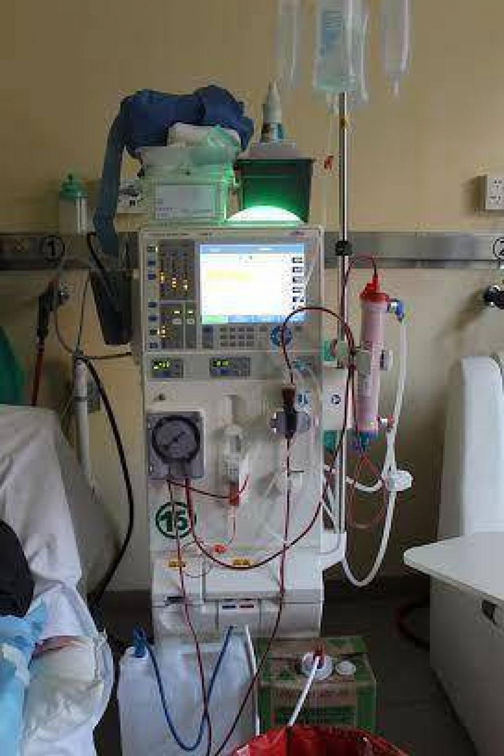 El Ministerio de Salud adquiri� equipamiento para los servicios de Hemodi�lisis