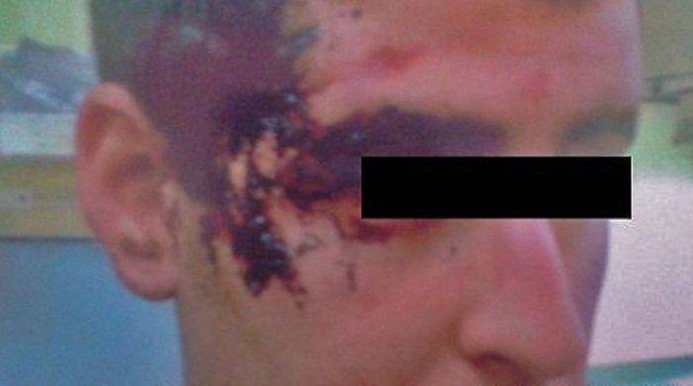 Joven de Punta Alta denunci� que fue golpeado por varios patovicas