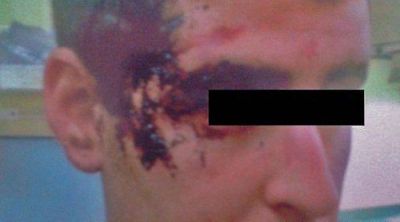 Joven de Punta Alta denunci� que fue golpeado por varios patovicas