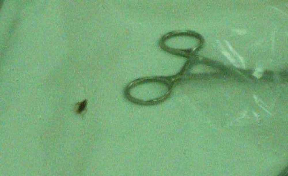 Denuncian que hay cucarachas en el Hospital Interzonal