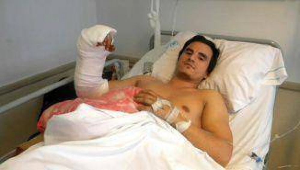 Realizaron la primera reimplantaci�n de mano en un nosocomio p�blico