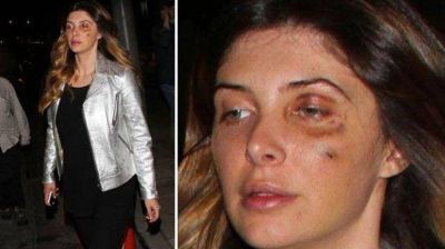 Atacaron a una ex de Luis Miguel