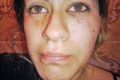 Salvaje ataque a una chica en el ba�o de un boliche