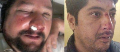 Dos dirigentes de la CTA marplatense fueron brutalmente agredidos