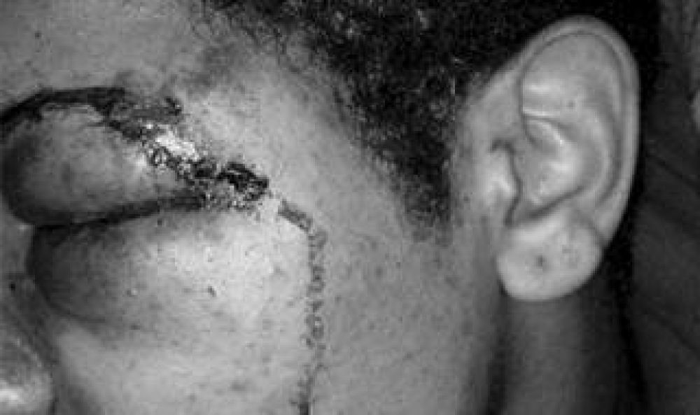Discriminaci�n en La Matanza: Feroz golpiza a un joven por ser gay