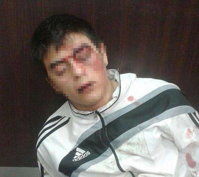 Brutal golpiza a un joven: denuncian que la polic�a nunca acudi� al llamado
