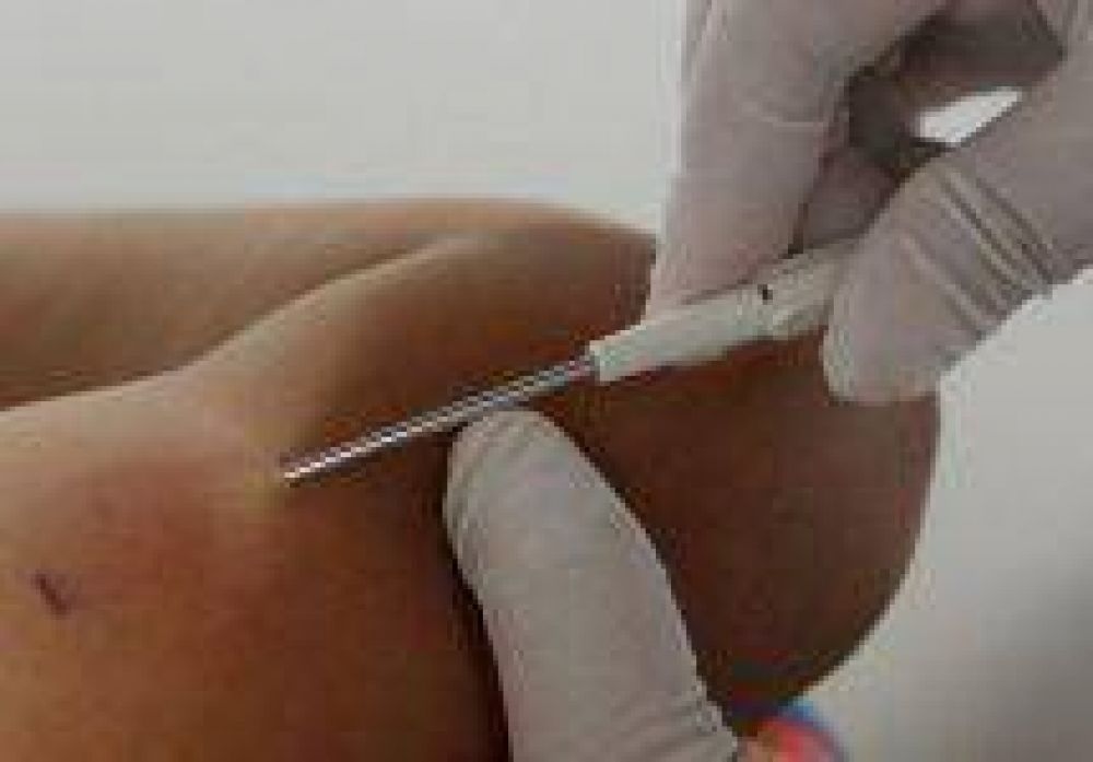 Novedoso anticonceptivo que se coloca en el brazo se distribuir� a adolescentes formose�as