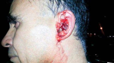 Apu�al� a taxista en una oreja porque no quisieron llevarlo