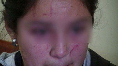Una alumna de 15 a�os sufri� una terrible golpiza