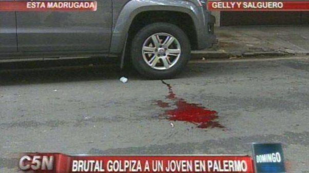 En un confuso episodio, le propinaron una golpiza al hijo de Julio Comparada