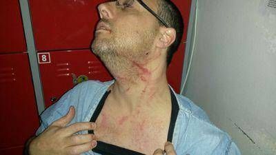 Agreden a m�dico de guardia en el hospital de Rawson