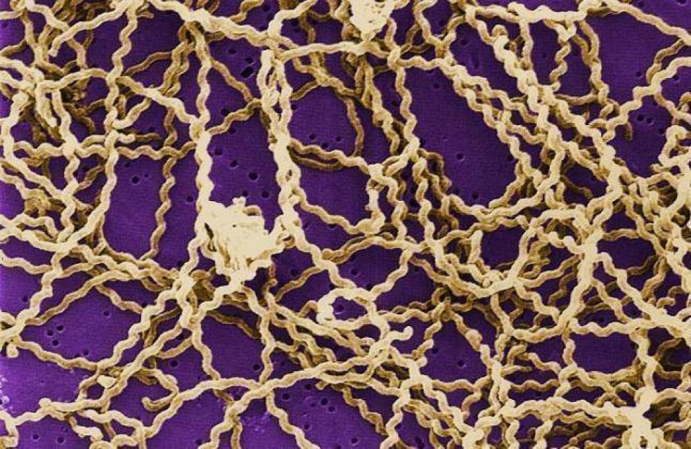 Alerta sobre la leptospirosis: Lo que hay que tener en cuenta