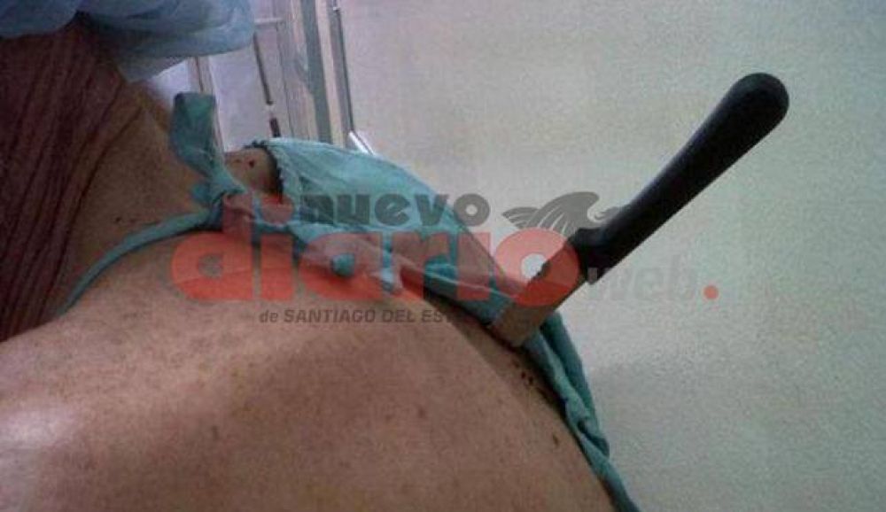 Defendi� a su hijo que era asaltado y fue acuchillado
