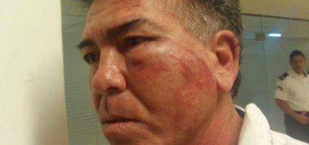 Lo agredieron brutalmente cuando realizaba una inspecci�n laboral