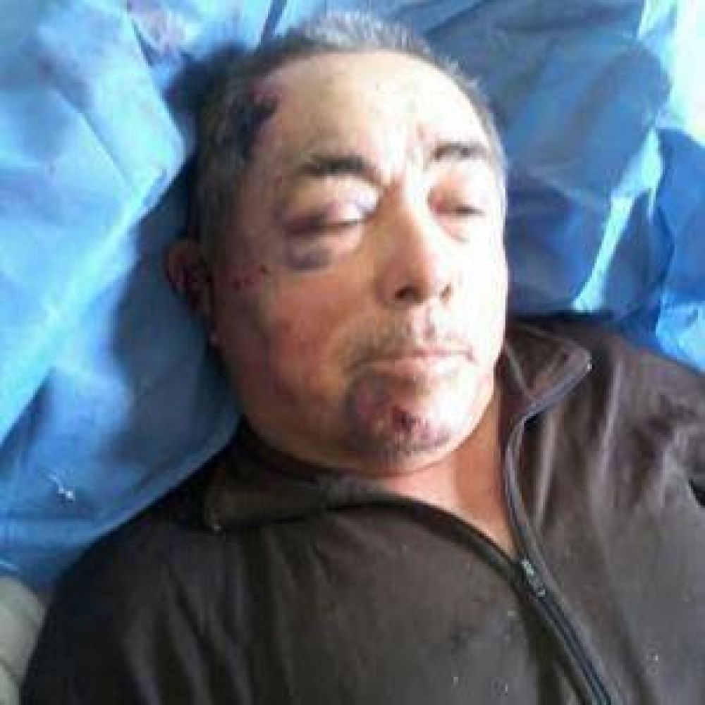 Asalto y brutal golpiza a una pareja para robarles $50.000