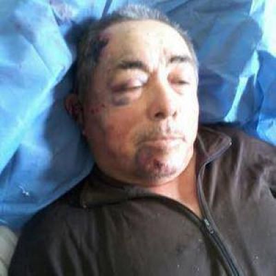 Asalto y brutal golpiza a una pareja para robarles $50.000
