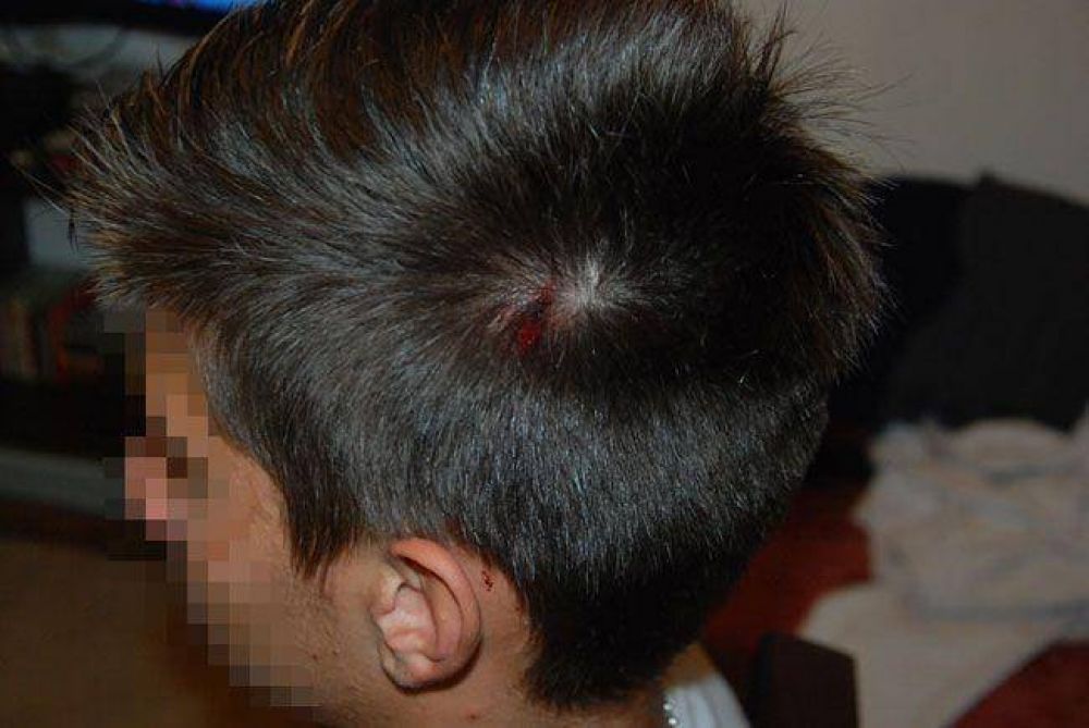 Un chico de 14 a�os jugaba a la pelota y lo hiri� un vecino en la cabeza: �un arma o una honda?