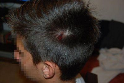 Un chico de 14 a�os jugaba a la pelota y lo hiri� un vecino en la cabeza: �un arma o una honda?