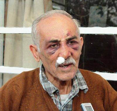 Otro abuelo sufri� una brutal golpiza al ser asaltado