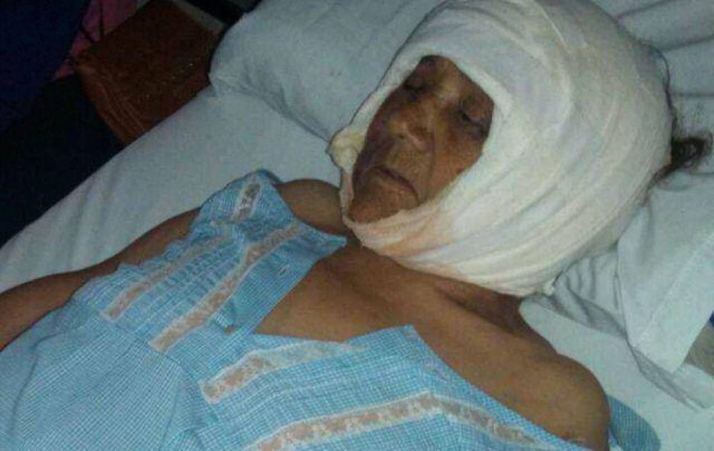 Una anciana fue ferozmente atacada por un Rottweiler