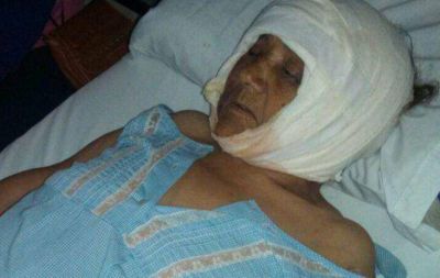 Una anciana fue ferozmente atacada por un Rottweiler