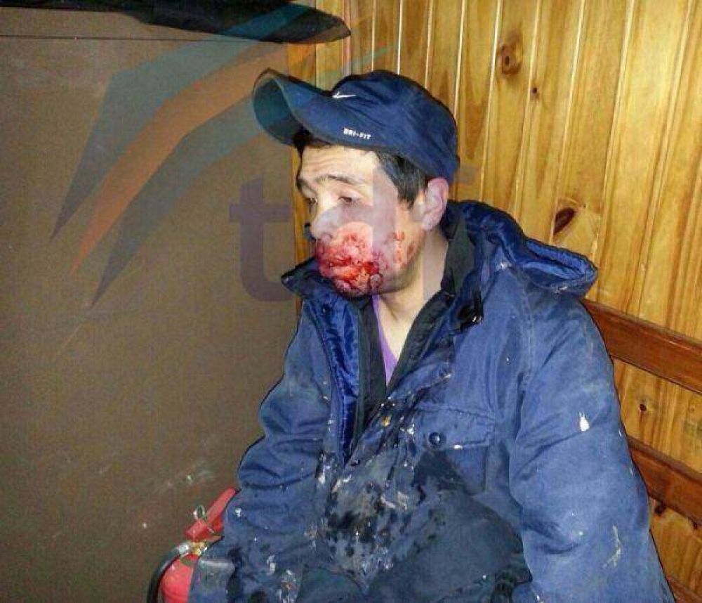 Est� pr�fugo el autor del disparo que desfigur� a un hombre