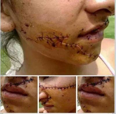 BRUTAL AGRESI�N A UNA ADOLESCENTE EN EL CIRCUITO 5