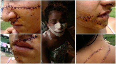 Formosa: dos hermanas desfiguraron a una menor por 