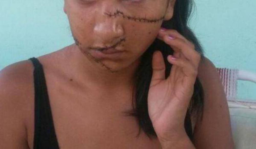 DETUVIERON A UNA DE LAS PERSONAS QUE AGREDI� A LA MENOR DEL C5