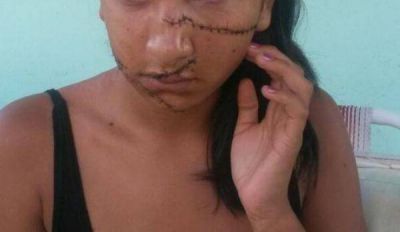 DETUVIERON A UNA DE LAS PERSONAS QUE AGREDI� A LA MENOR DEL C5