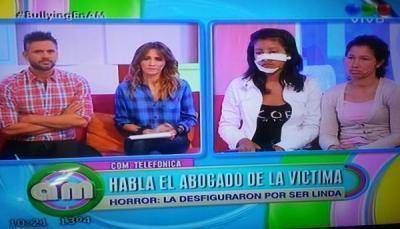 Buscaron ayuda en Bs As. Le van a reconstruir la cara. Denuncian que las agresoras 