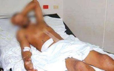 Un joven gravemente herido de bala en un tremendo disturbio