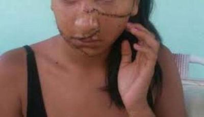 CASO DE LA MENOR AGREDIDA EN C5: CAMBIARON LA CARATULA A TENTATIVA DO HOMICIDIO