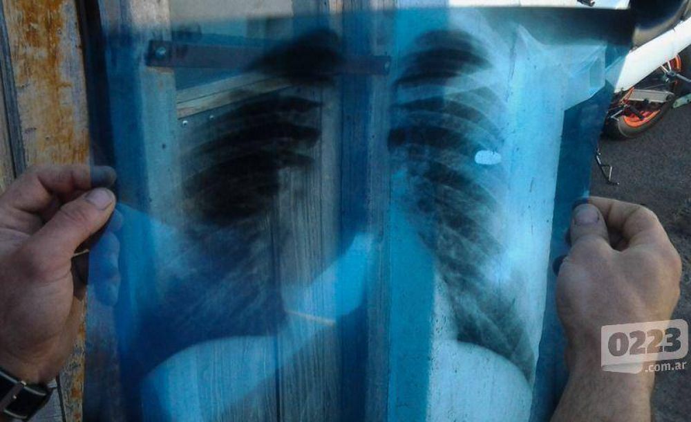 Radiograf�a de un milagro: le disparan y le queda la bala en el cuerpo