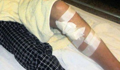 Ajuste de cuentas: Un joven fue herido de 3 balazos en Chimbas
