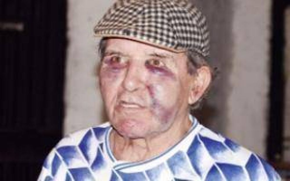 La Plata: Ataron y desfiguraron a jubilado de 72 a�os para robarle