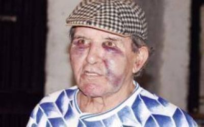 La Plata: Ataron y desfiguraron a jubilado de 72 a�os para robarle