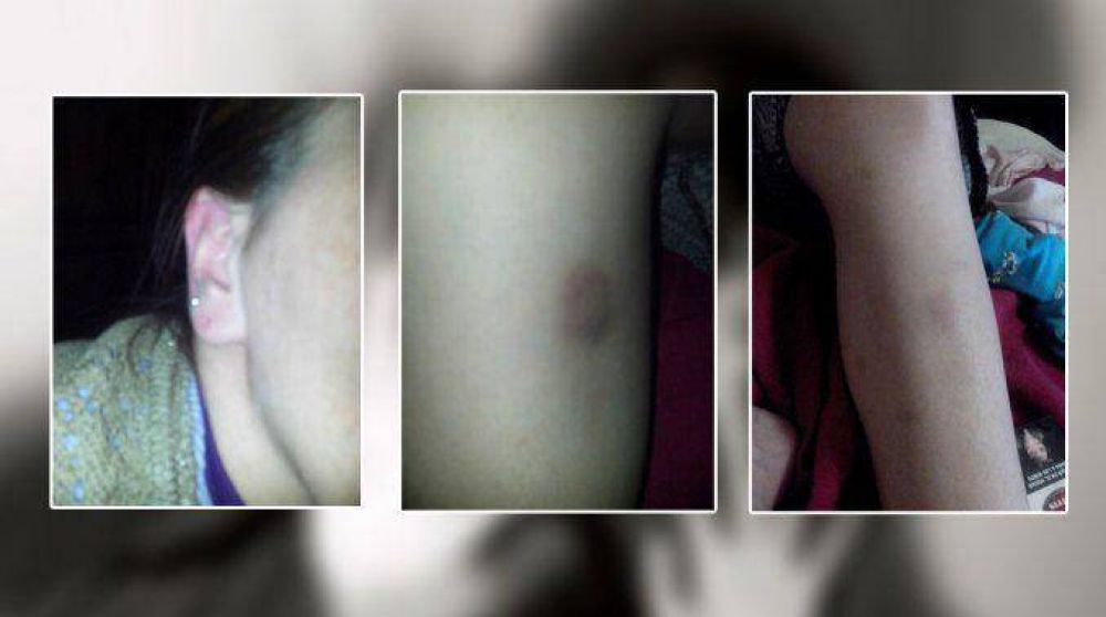 El conmovedor relato de una joven v�ctima de violencia de g�nero