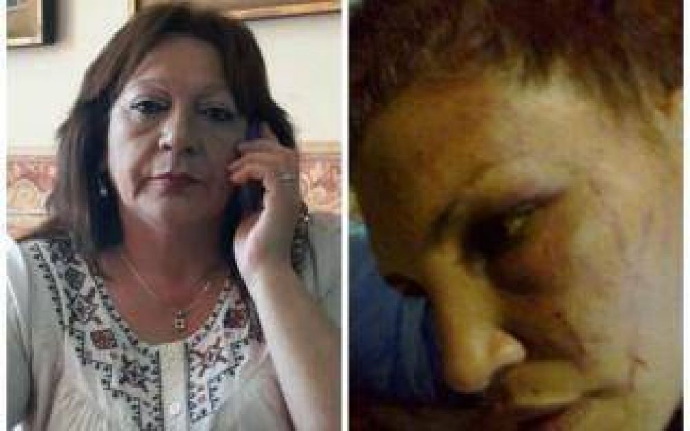 Mor�n: Acusan a concejala massista por desfigurar a una embarazada