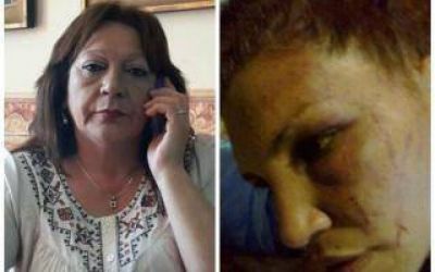 Mor�n: Acusan a concejala massista por desfigurar a una embarazada