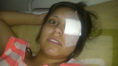 El crudo relato de Romina, la chica baleada en el ojo