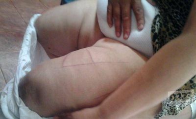 Denunci� que fue violada, amenazada y quemada: muri� en el Higa