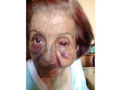 Denuncian maltrato a una mujer en un hogar de ancianos