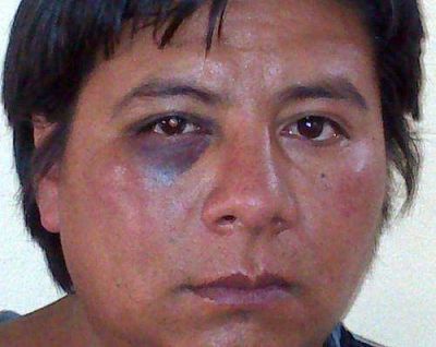 Vocal municipal de Yavi denunci� que fue atacado por un empleado de Migraciones