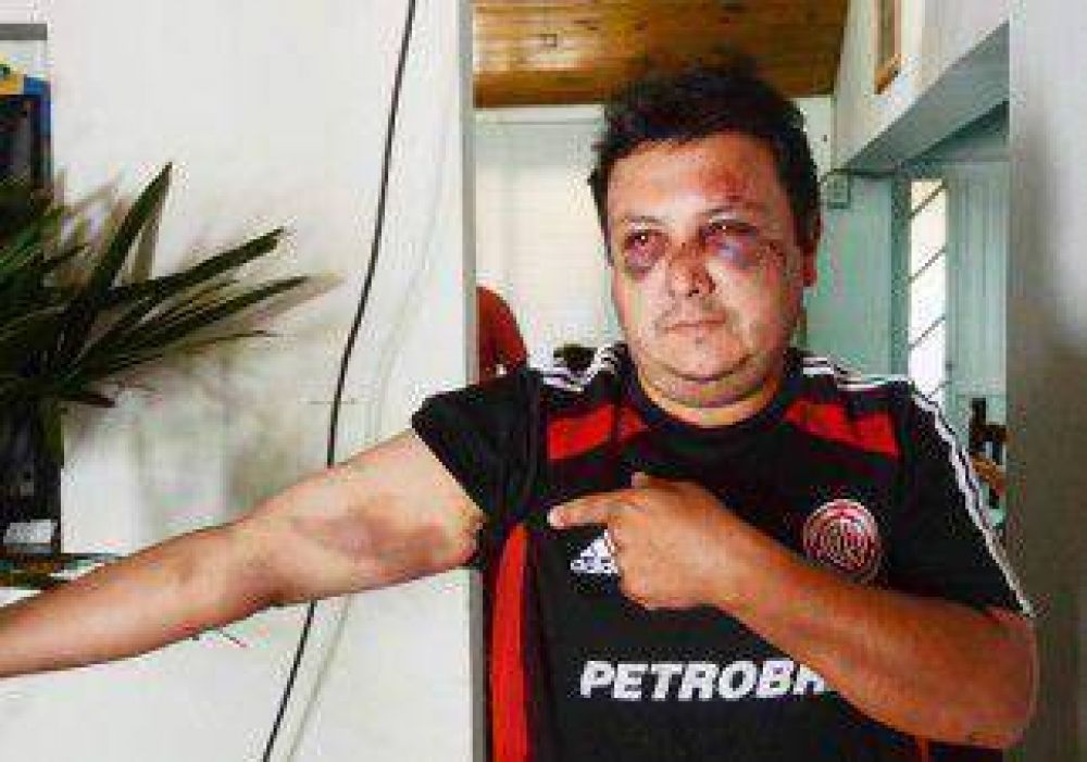 Denuncian una feroz golpiza de la Polic�a 